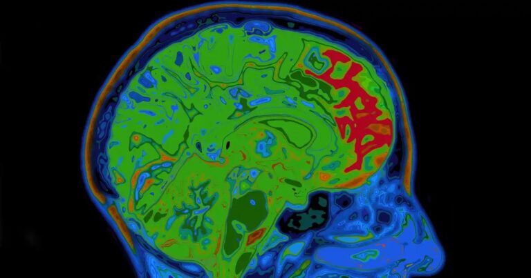 Mechanismus odměny v mozku a jeho vliv na zlozvyky