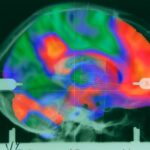 Nizozemští neurovědci zpochybňují novou techniku analýzy duševních nemocí: 'Základní mylná úvaha'